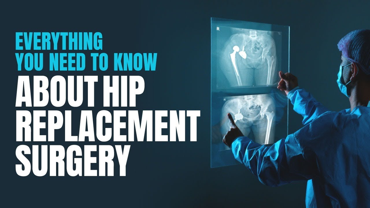 Everything You Need To Know About Hip Replacement Surgery | Medicover ...