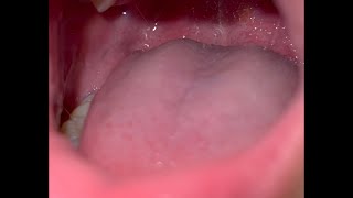 Mouth Tour Video, Update
