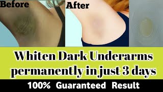 Whiten Dark Underarms Permanently|100% guaranteed result| In 3 days Lightening Armpits(Urdu/Hindi)