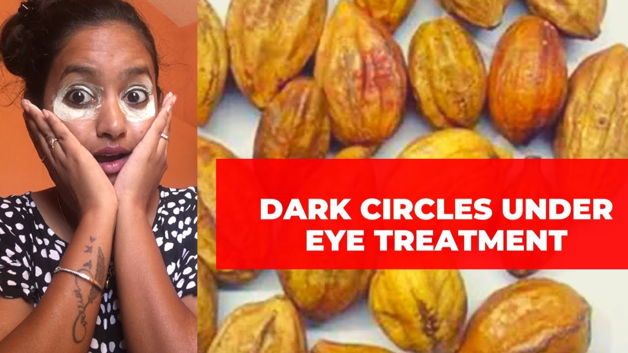 Dark circles under eye treatment kadukay review Home remedy Tamil