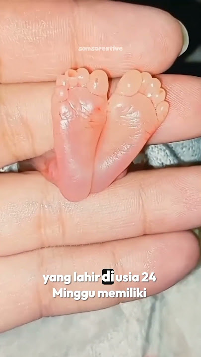 Premature Babies This Small #baby #baby #shorts #shortvideo #short