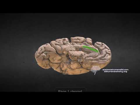 Vídeo: Rama Pericallosal Posterior De La Arteria Cerebral Posterior - Mapas Corporales