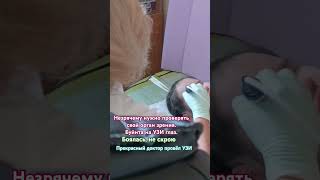 УЗИ глаз