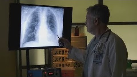Experts discover alarming culprit behind mystery lung cancer surge in never-smokers...