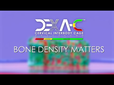 DEXA Technology™ Simulation