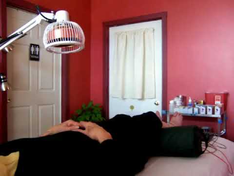 Maple Ridge Acupuncture in Penn Yan, NY