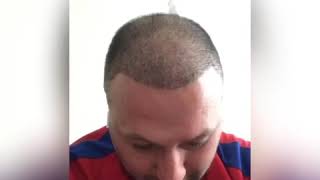 Saç Hakkında Her Şey