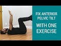 How to fix Tight Hips with one Anterior Pelvic Tilt correction exercise - REAL case study