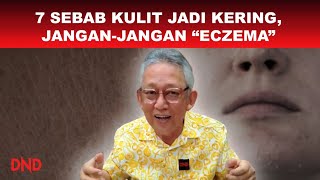 7 SEBAB KULIT JADI KERING…. JANGAN JANGAN EKZEMA!