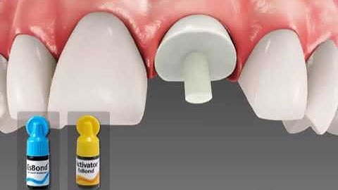 Σύστημα ανασύστασης - Spident Core It Dual