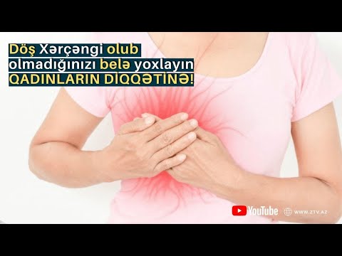 Video: Çəhrayı Rəngdə: Döş Xərçəngi Haqqında Bilməli Olduğunuz şey