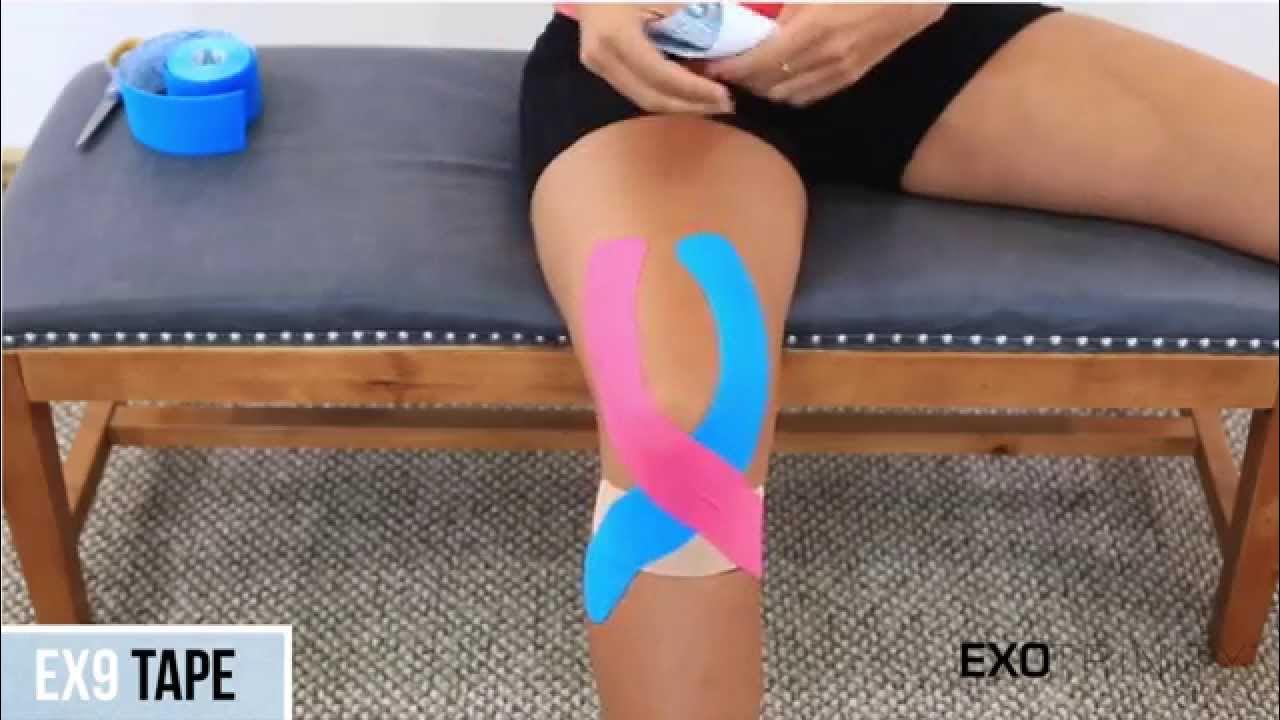 EX9 Kinesiology Tape Patella Knee Pain YouTube