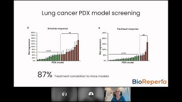 Patient-derived xenograft in the zebrafish larvae. A highly translatable model!
