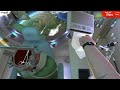 Surgeon Simulator 2013 Space Brain Transplant Former WR | 8.697s