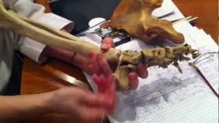 видео Голеностопный сустав: строение, анатомия и его заболевания