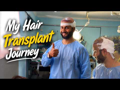 I Did My Hair Transplant 👨🏼‍🦰