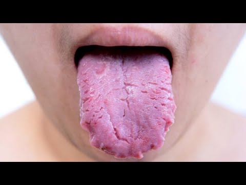 Warning Signs Your Body Needs Vitamin B12 | Natural medicine