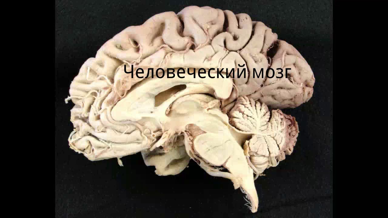 Настоящий человеческий. Сагиттальный разрез мозга препарат. Человеческий мозг в разрезе.