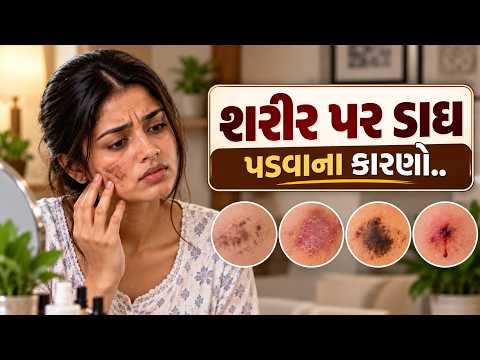 શરીર પર ડાઘ પડવાના કારણો! || Bhakti Path