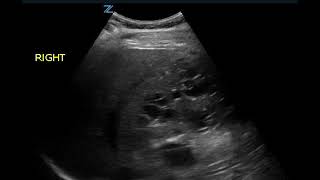 健康・医学 ATLAS OF Renal Ultrasonography O'NEILL 健康・医学 ATLAS OF Renal Ultrasonography O'NEILL Atlas of