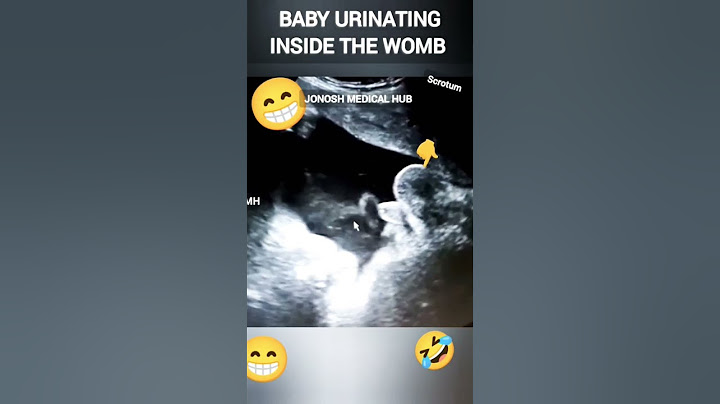 BABY URINATING INSIDE THE WOMB. #pregnancy #pregnancyscan #baby #abdomen #ultrasound #JMH #JDH