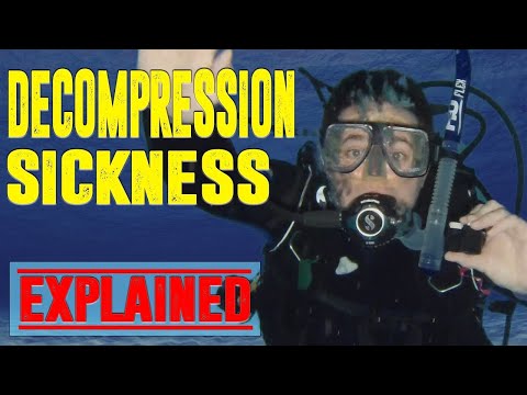 Decompression Sickness - The Bubbles You need to Worry About