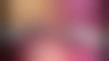 Right Laparoscopic Pyeloplasty - Unedited