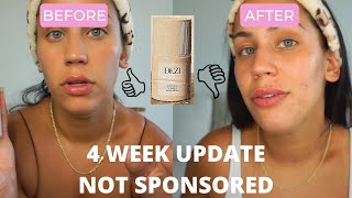 I USED DEZI SKIN FOR A MONTH... IM NOT HAPPY WITH MY RESULTS