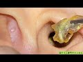 ASMR驚愕映像：耳の中にこんな物が！？