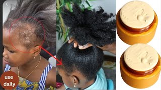 The Most Potent Hair Growth Butter 😱Do Not Wash It Out Only 4 Ingredients To Grow Hair Like Crazy
