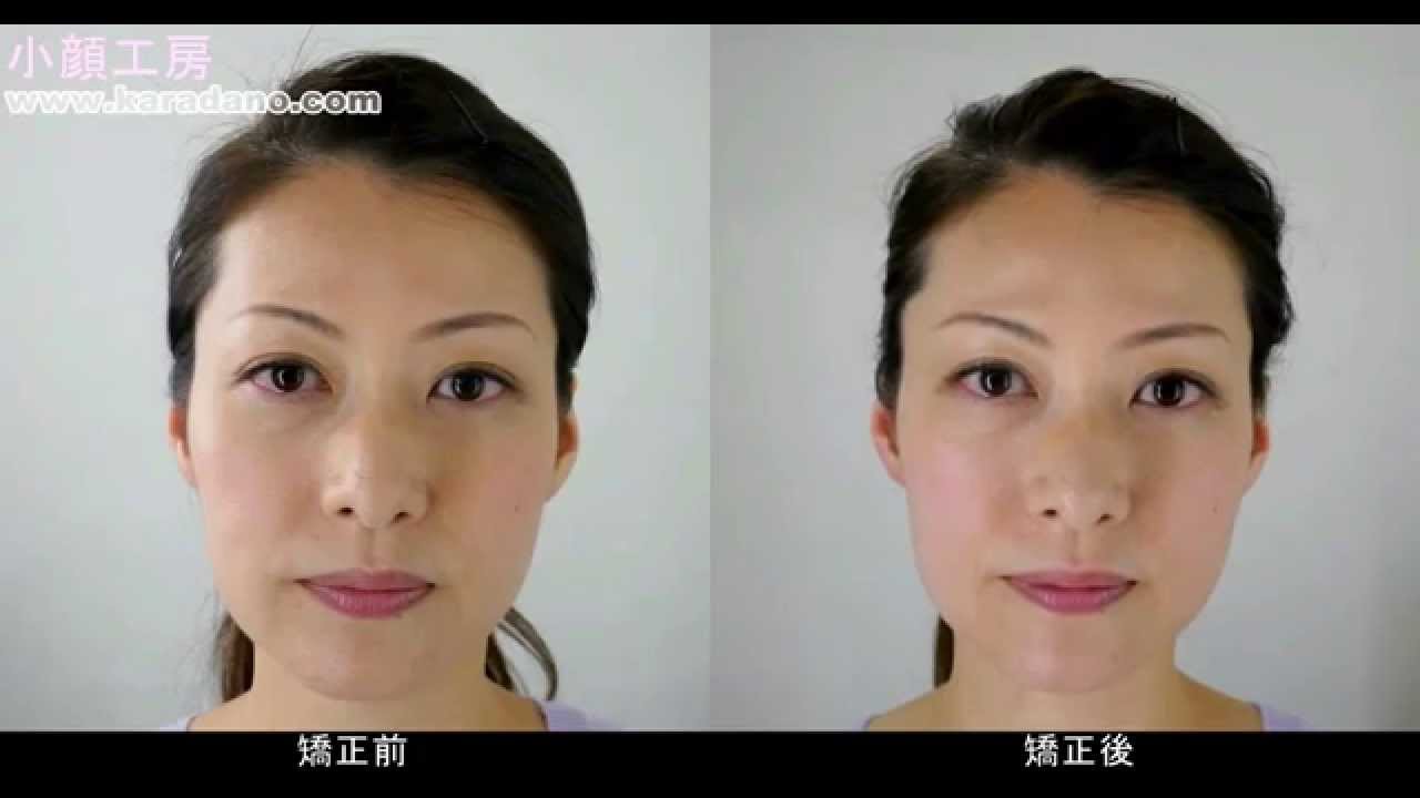 小顔矯正の前後動画ver１ 小顔工房 瞬間小顔コース Youtube