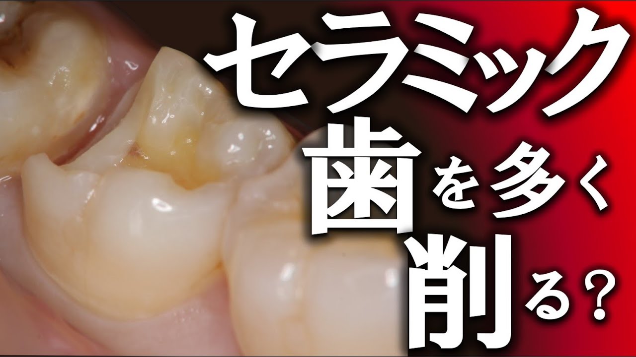 セラミック 削る方法: セラミックの切断方法 – ZSCCP