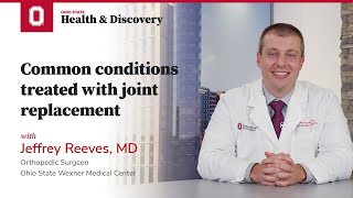 Common conditions treated with joint replacement | Ohio State Medical Center