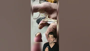 Biggest Blister 