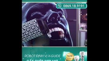 Công Nghệ Cấy Ghép Implant Bằng Robot Định Vị X-Guide tại Nha khoa Vindental Luxury