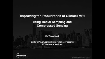 Improving the Robustness of Clinical MRI -- Using Radial Sampling and Compressed Sensing