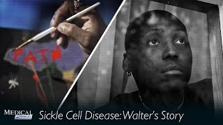 Medical Stories - Sickle Cell: Walter’s Story