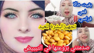 سواد 20 سنة سيزول/وصفة رهيبة لتبييض الوجه والجسم في دقيقة بشرة صافية نساي الكلف والتصبغات/آثار الشمس