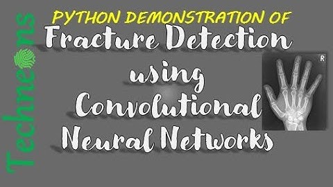 Fracture Detection using Convolutional Neural Networks| Python| Techneons
