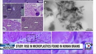 Study: Microplastics are making their way into humans’ bodies, even reaching the brain