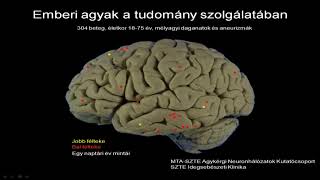 Prof. Dr. Tamás Gábor: Mi teszi az agyunkat emberivé?