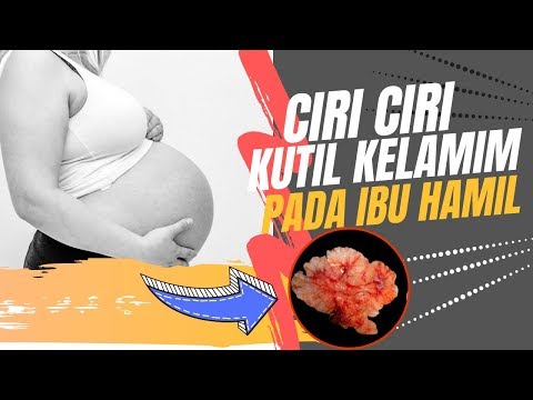 ciri-ciri-kondiloma-(kutil-kelamin)-pada-ibu-hamil