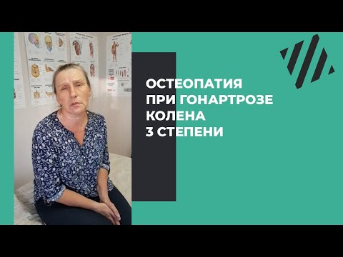 Остеопатия при гонартрозе колена 3 степени