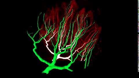 Amira | 3D visualization and analysis | 3D visualization of a Neuron