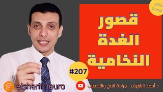 قصور الغدة النخامية | د أحمد الشريف #207