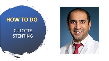 How to do culotte bifurcation stent technique (made simple)