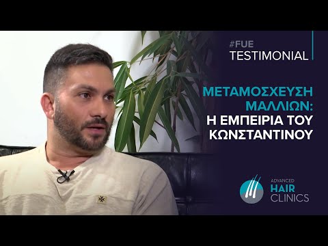 Testimonial: Μεταμόσχευση Μαλλιών Πριν και Μετά - Kωνσταντίνος #FUE