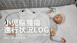 【闘病LOG#01】水頭症手術の記録