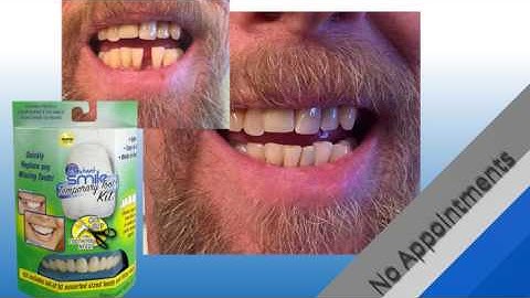 Instant Smile Temporary Tooth Kit