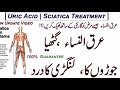 Sciatica pain complete treatment by dr aijaz hyder